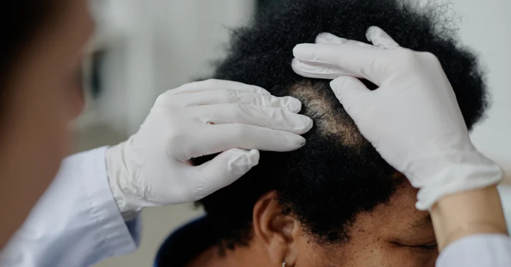 Dermatologist examining scalp for hair health