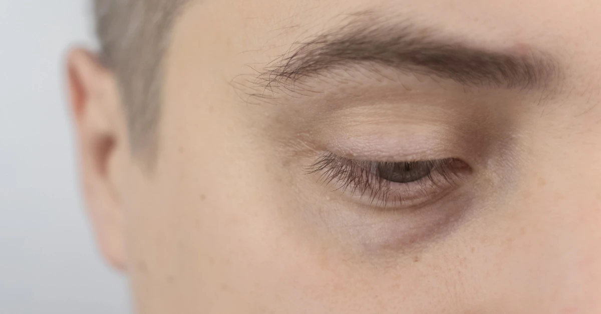 Close-up of a man's tired eye showing puffy skin underneath